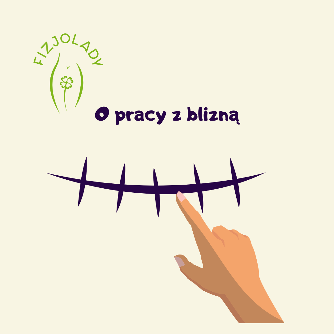 Okładka artykułu Jak pracować z blizną po cesarskim cięciu